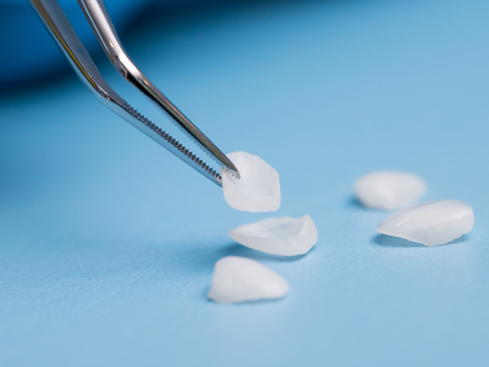 Tweezers grabbing a dental veneer