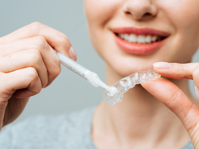 Person placing gel into a teeth whitening tray