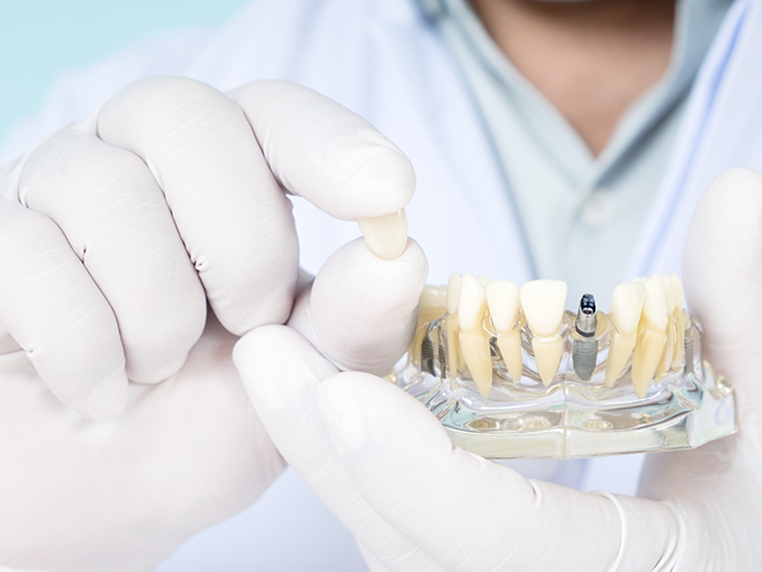 Dentist holding a model of a dental implant in Bethlehem