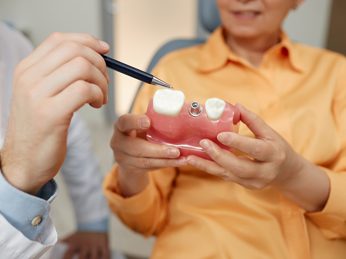 Dentist showing a model of a dental implant to a patient