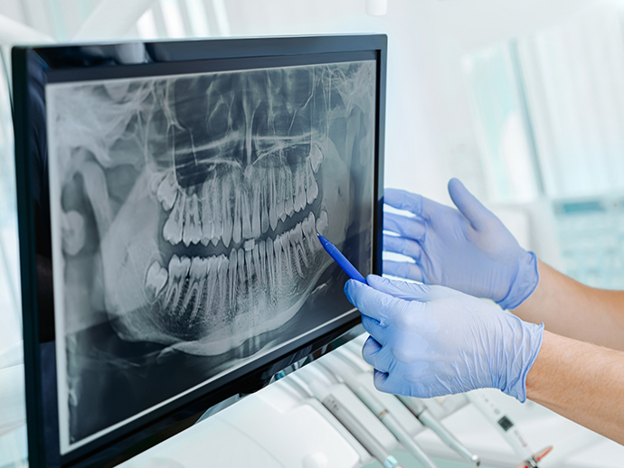 Dentist gesturing to a screen showing an x ray of teeth