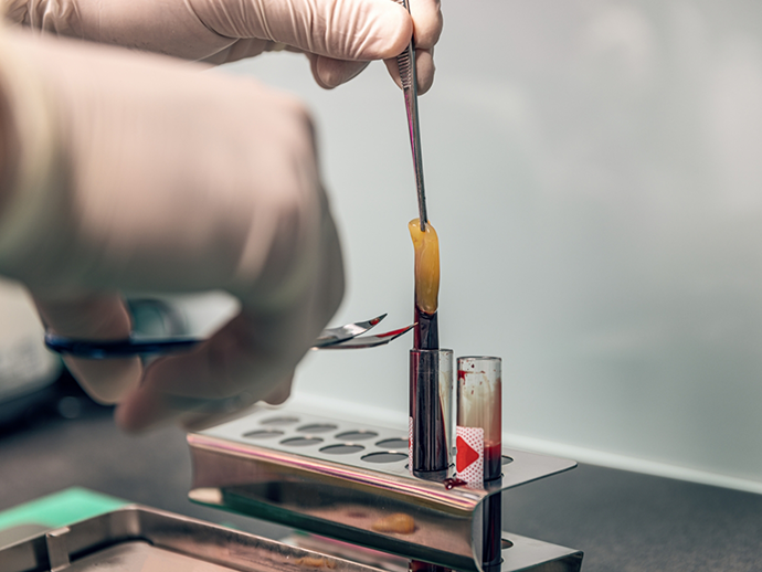 Gloved hands adjusting a cylinder filled with a blood sample