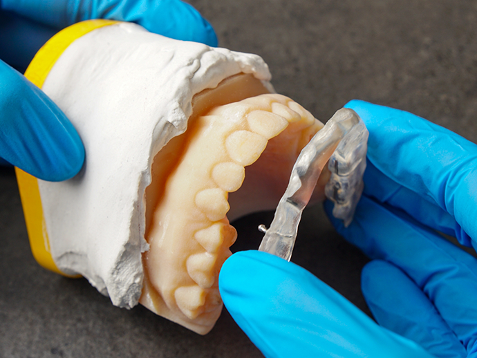 Dentist placing a splint tray over the teeth in a model of the jaws